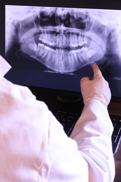 Best Emergency Treatment for Dental Infections or Abscesses in Carbondale, CO