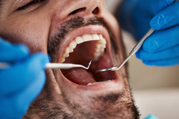 Best Emergency Treatment for Dental Infections or Abscesses in Carbondale, CO